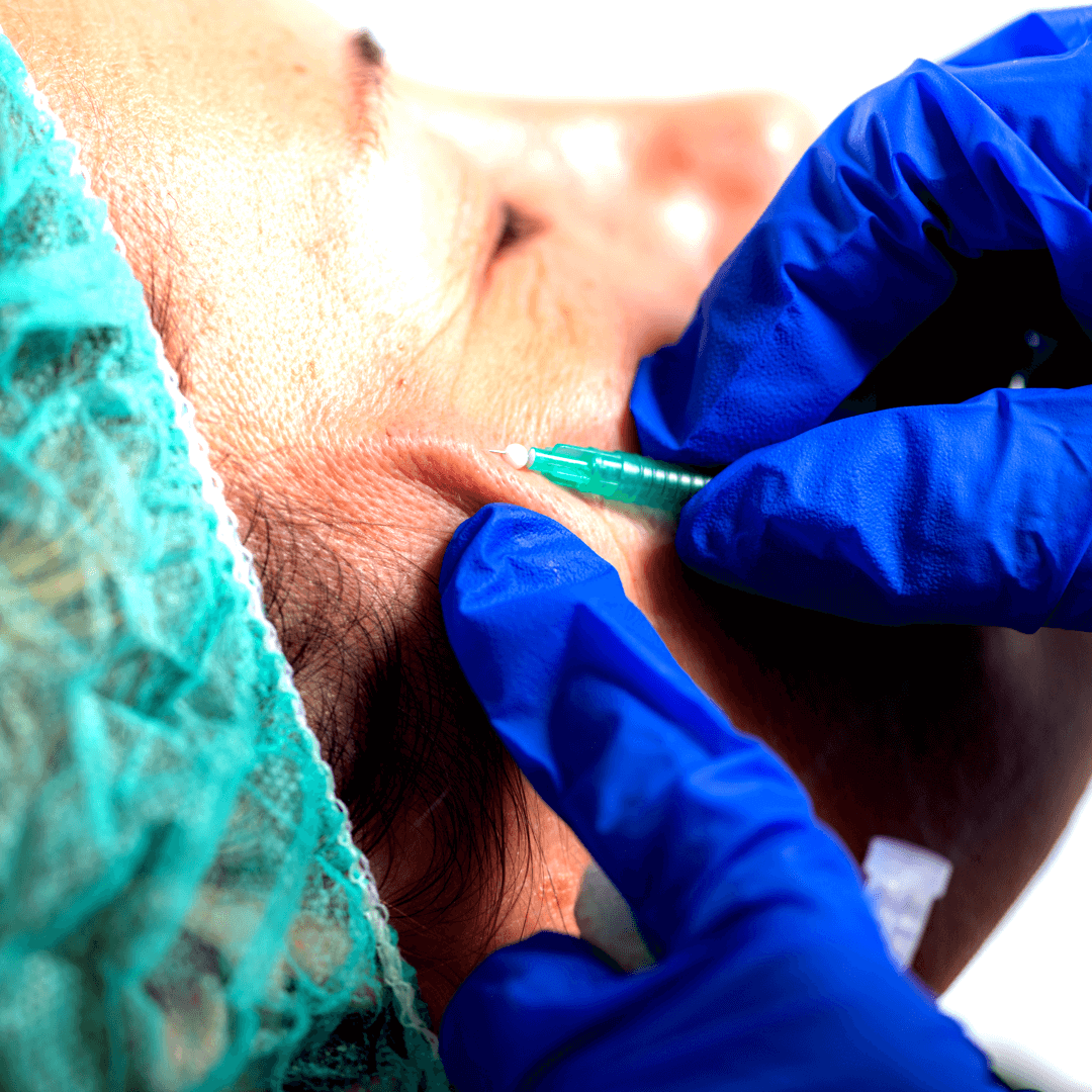 Medicina Estética Facial 2 Hospital Cádiz, Clínica Digestiva Medicina Estética Facial Hospital Cádiz, Clínica Digestiva