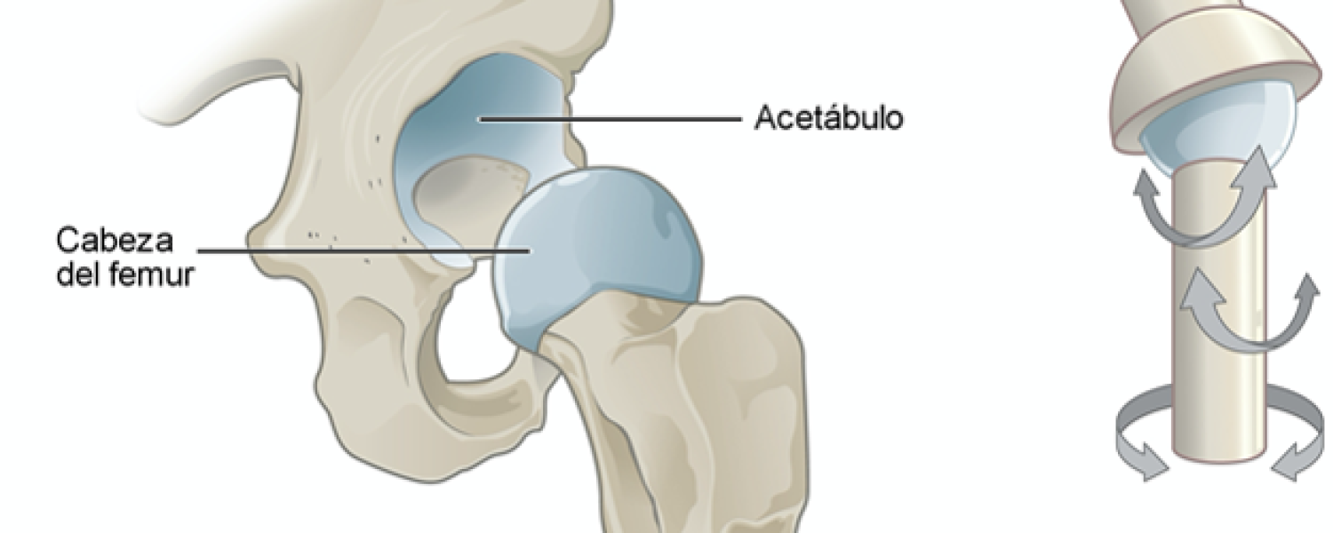 la-luxacion-de-cadera